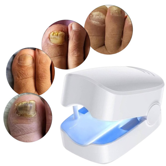 Nail Fungus Treatment Device