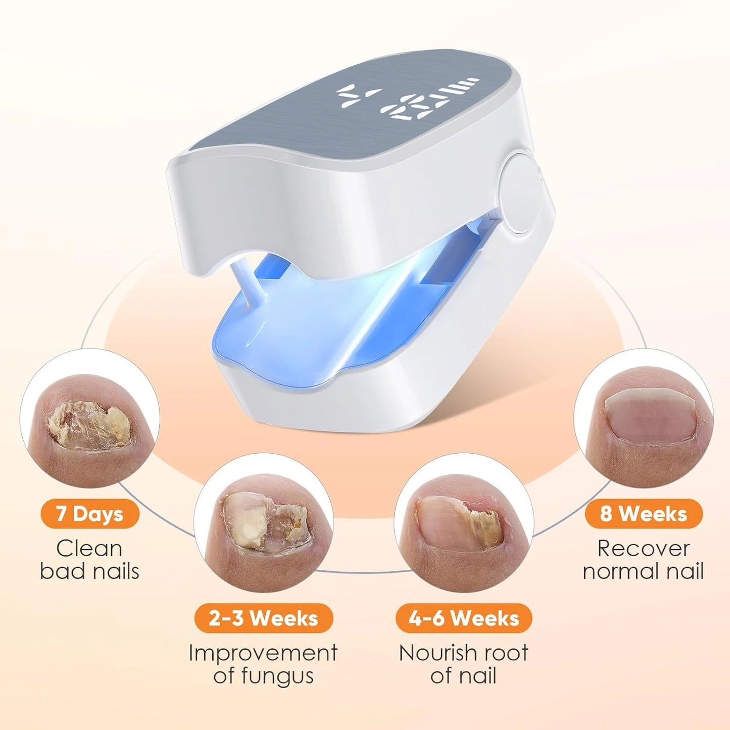Nail Fungus Treatment Device