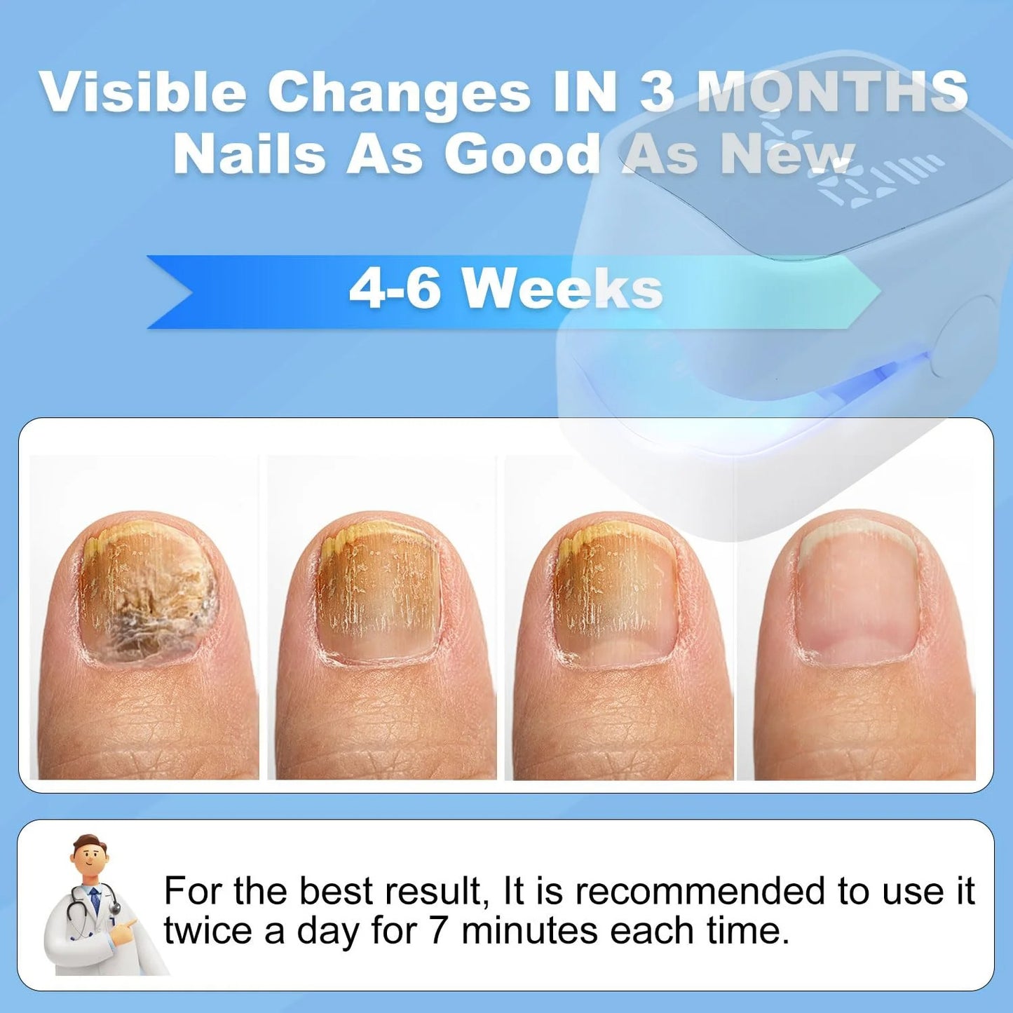 Nail Fungus Treatment Device